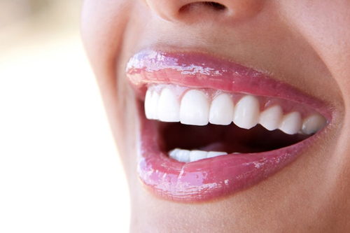 Full Mouth Rehabilitation
